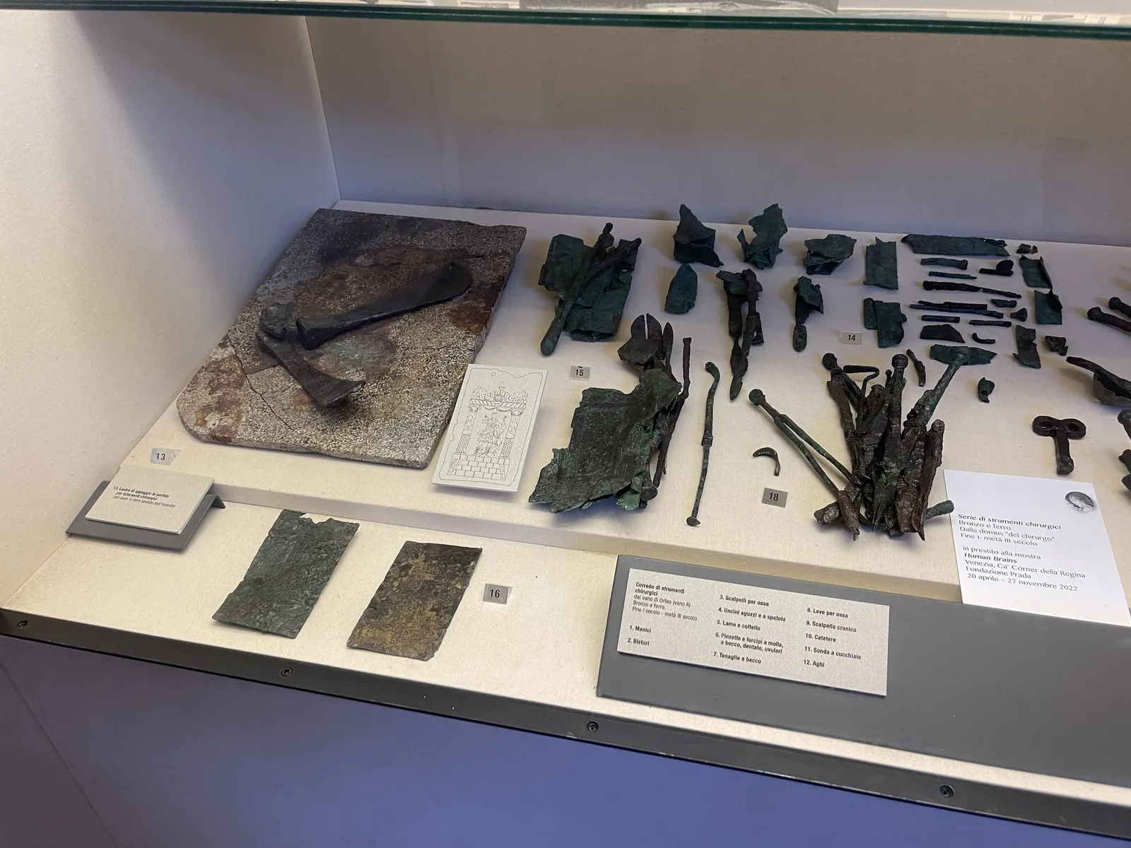 Case of Roman bronze surgical instruments and fragments from the Domus del Chirurgo